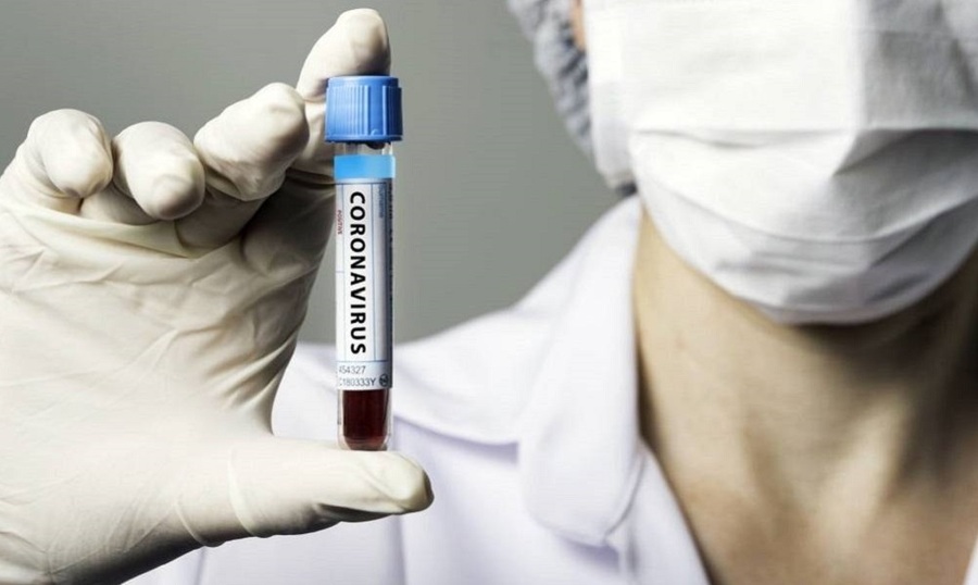 В Чувашии ежедневно в течение почти трех недель фиксировались смерти от коронавируса